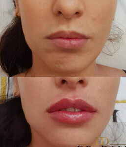 marire buze dr dali constanta 1