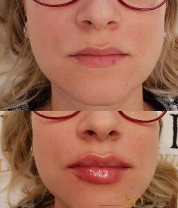 marire buze dr dali constanta 2