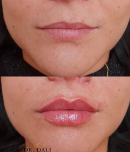 marire buze dr dali constanta 3