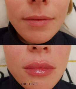 marire buze dr dali constanta 4