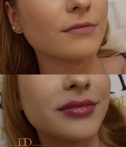 marire buze dr dali constanta 6