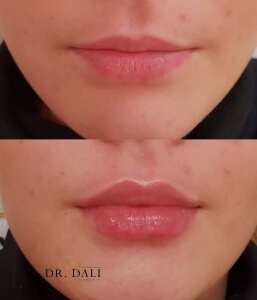 marire buze dr dali constanta 7