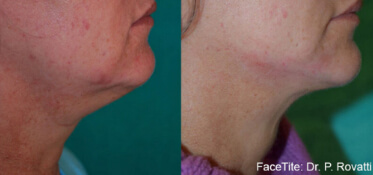 2facetite constanta dr dali