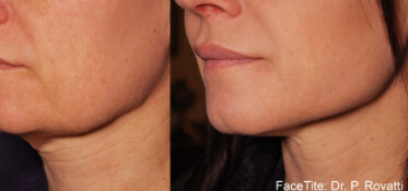 3facetite constanta dr dali