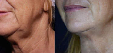 4facetite constanta dr dali