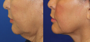 5facetite constanta dr dali