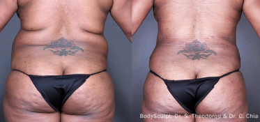 bodytite constanta dr dali