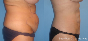 bodytite constanta dr dali1