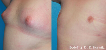 bodytite constanta dr dali2