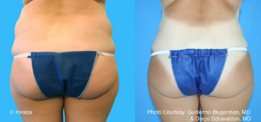 bodytite constanta dr dali4