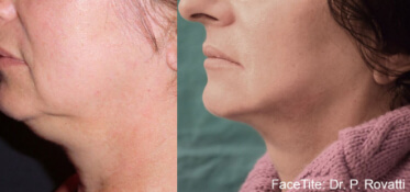 facetite constanta dr dali